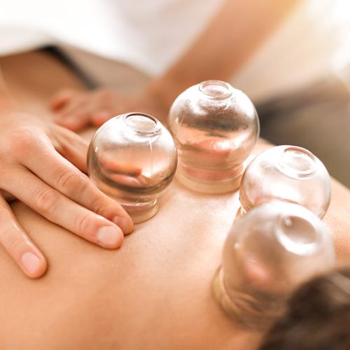 Could_You_Benefit_From_Cupping_Therapy
